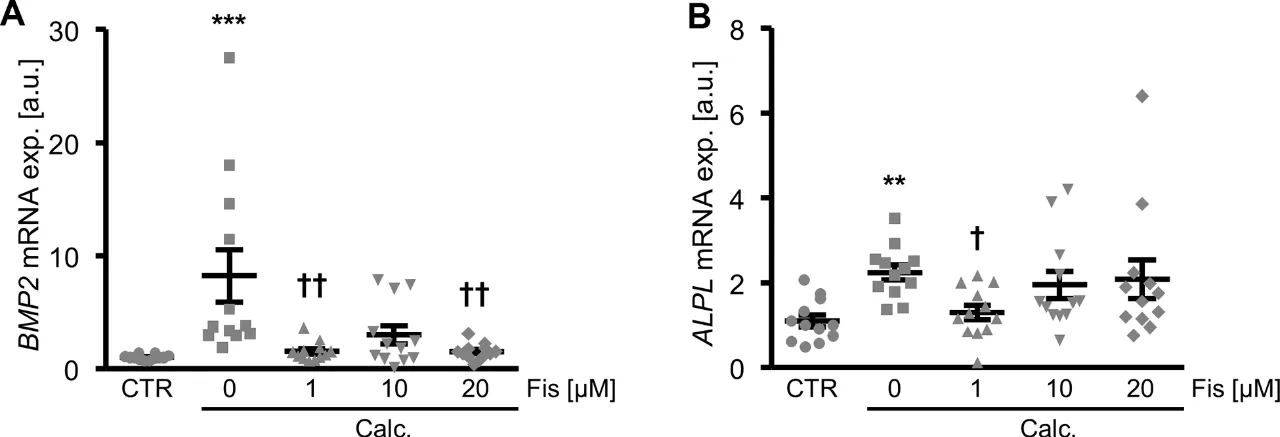 The Complex Process of Vascular Calcification The Complex Process of Vascular Calcification