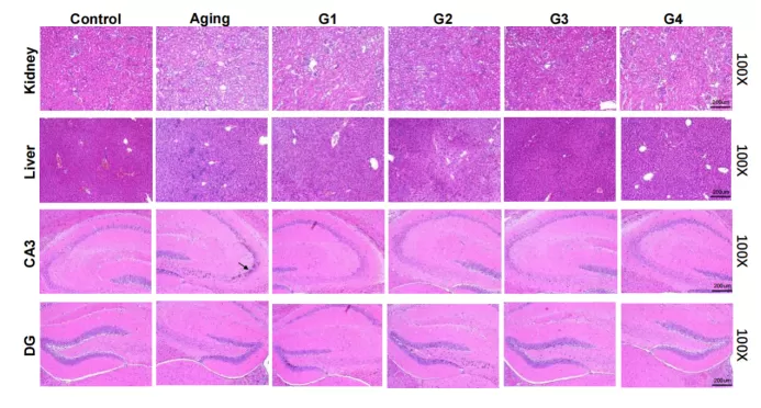Resultados convincentes no modelo de envelhecimento natural Resultados convincentes no modelo de envelhecimento natural