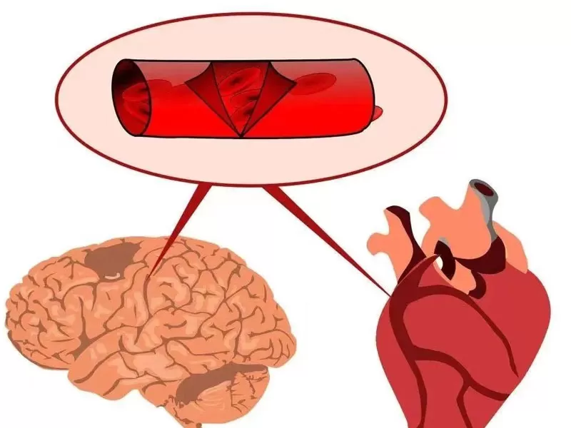 Série Anti-Envelhecimento: Resveratrol