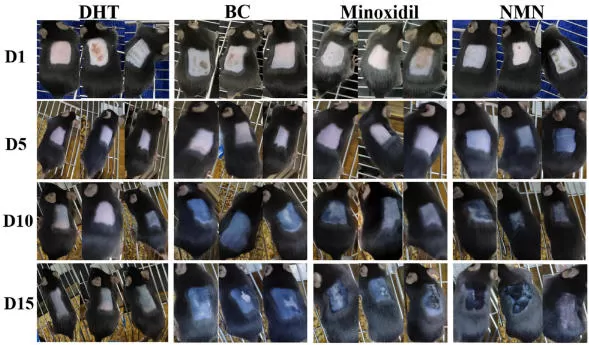 NMN e crescimento do cabelo: novas evidências na alopecia androgenética (AGA)
